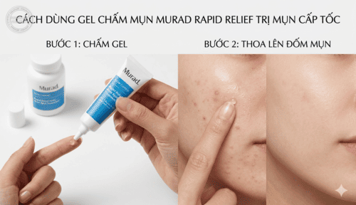 Cách dùng gel chấm mụn Murad Rapid Relief trị mụn cấp tốc